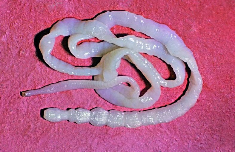 Bovine tapeworm is a common intestinal worm. 